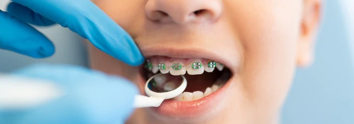Orthodontist Orlando FL Two Phase Process Doctor Checking Out Boys Braces Check Up Two Phase Process Doctor Checking Out Boys Braces Check Up